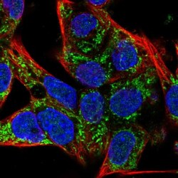 SLC25A42 Antibody, Novus Biologicals:Antibodies:Primary Antibodies